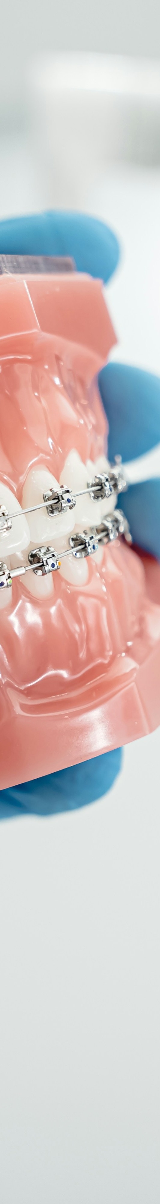 치아교정 후 유지 장치의 필요성 관련 이미지 12