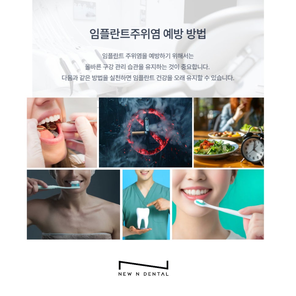신논현역치과 임플란트주위염 예방방법은 관련 이미지 6