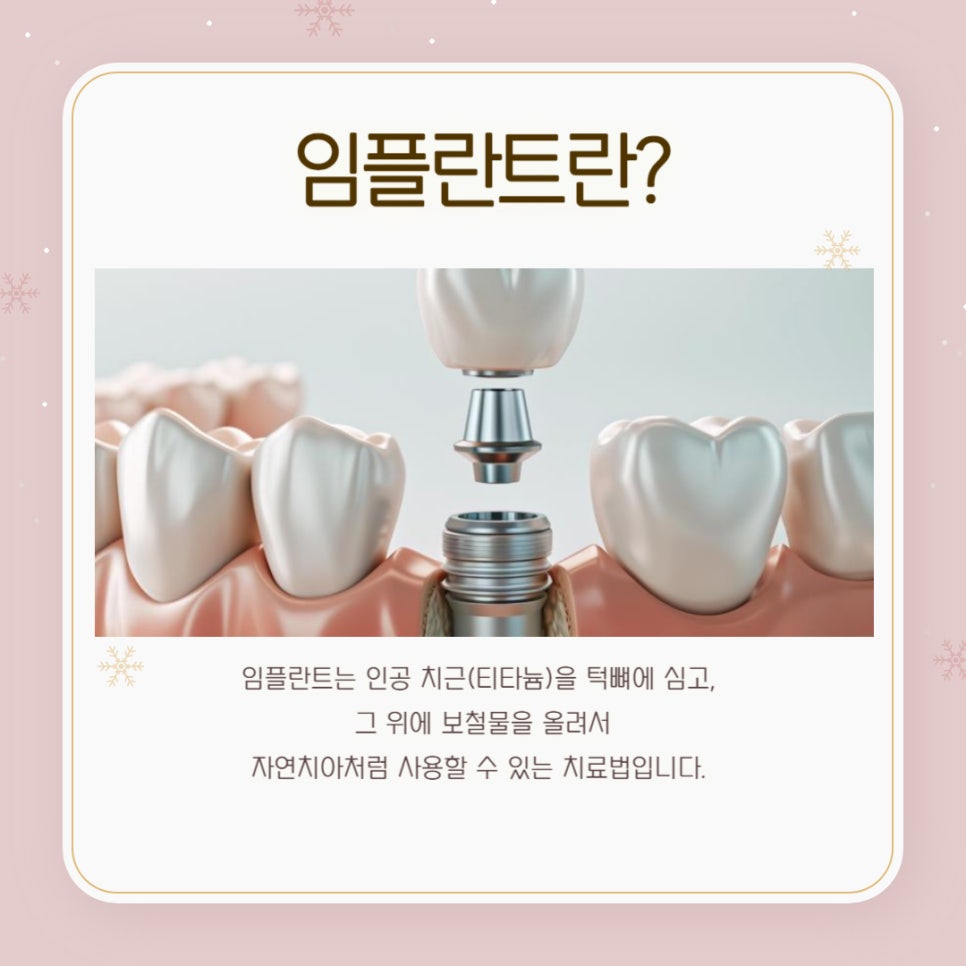 임플란트와 틀니 차이점, 나에게 맞는 선택은? 관련 이미지 2