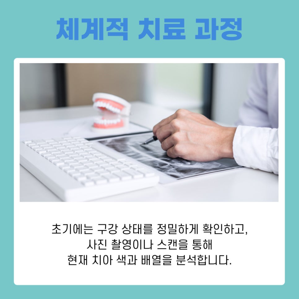 강남 논현동치과 치아미백 작용 원리와 유지 관리 방법 정리 관련 이미지 8