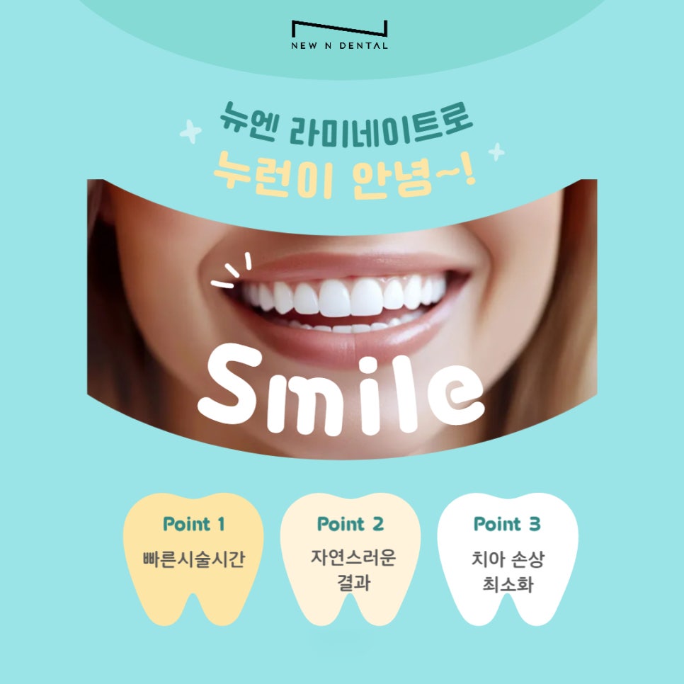 강남라미네이트 잘하는 곳 뉴엔치과 관련 이미지 5