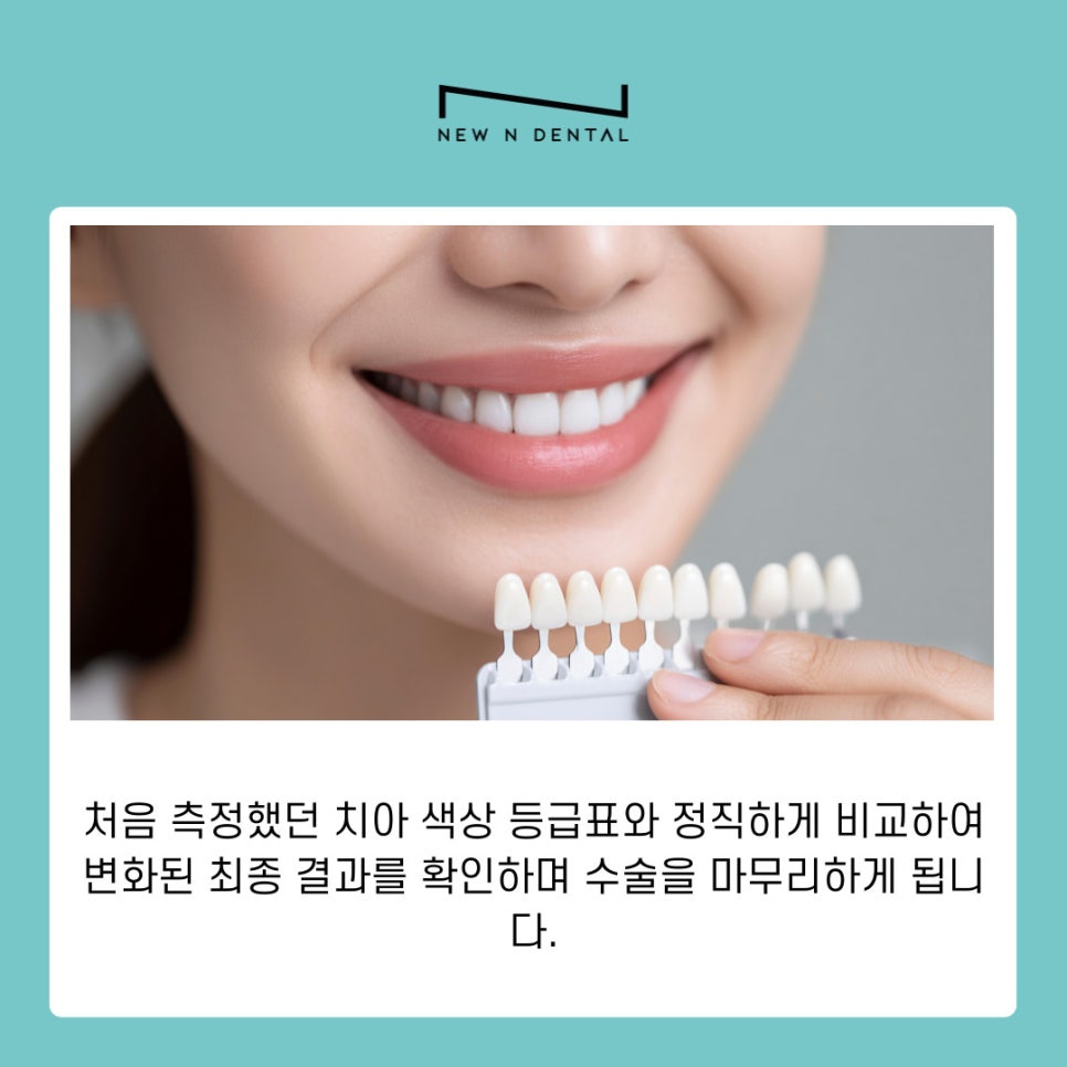 Gangnam Teeth Whitening: A Choice for Regaining a Clear and Radiant First Impression image 9