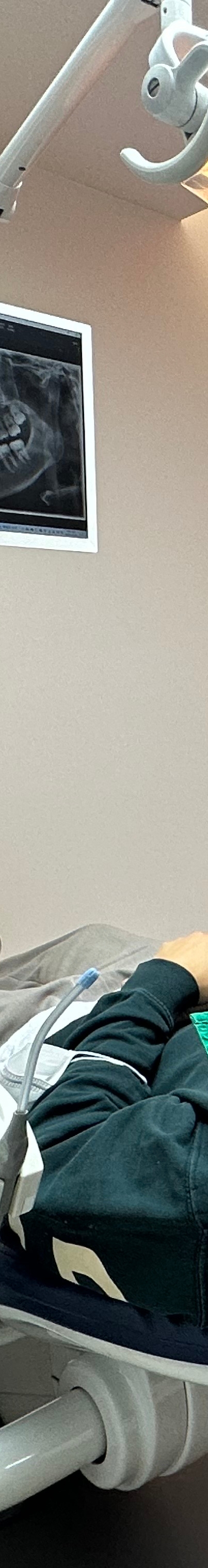 논현역치과 임플란트주위염 알아보기 관련 이미지 22