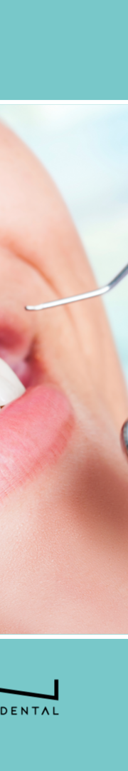 치아변색원인과 스케일링치료로 개선하는 방법 관련 이미지 13