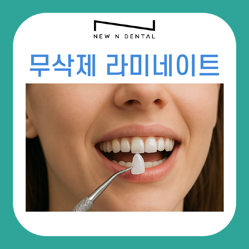 무삭제 라미네이트 저도 받을 수 있을까요? 관련 이미지 2