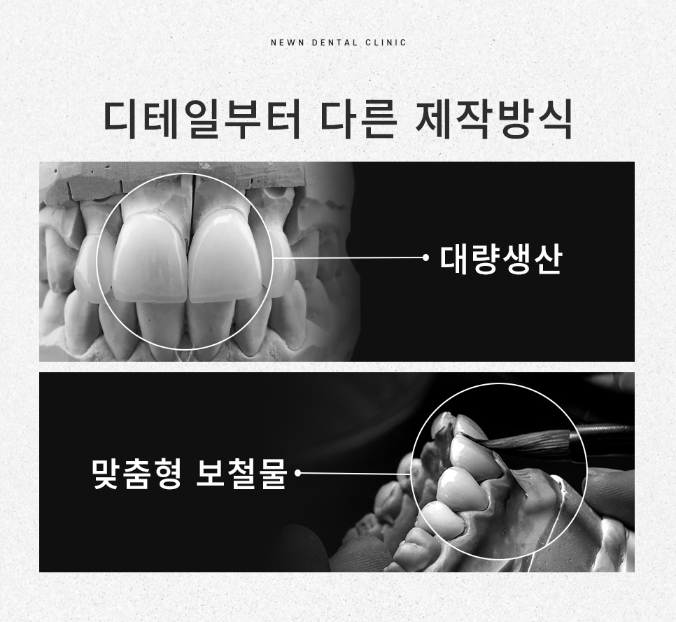 강남역 뉴엔치과 일반 라미네이트와 퍼스널라미의 차이점 관련 이미지 12