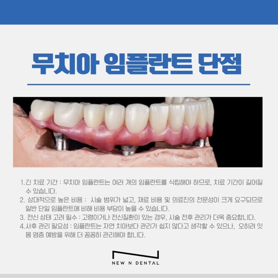 신논현치과 무치아 임플란트, 틀니보다 확실한 선택 관련 이미지 4