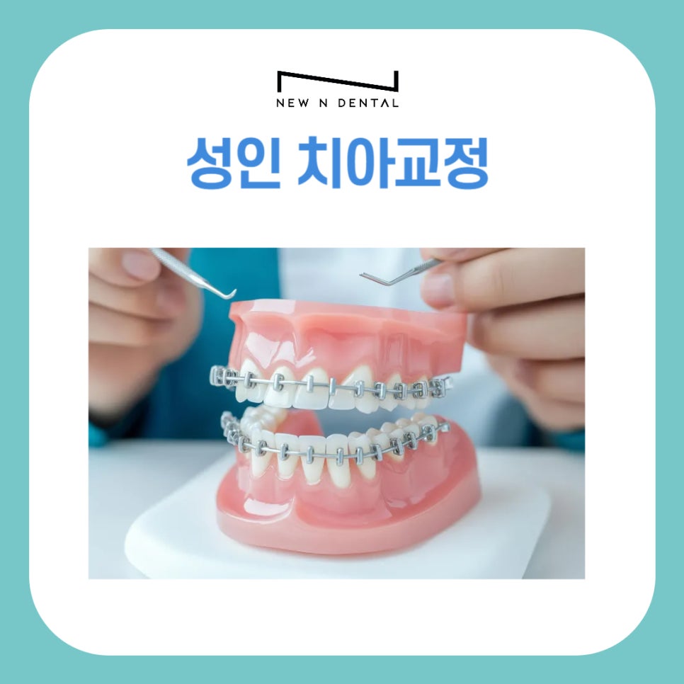Adult Orthodontic Treatment Costs and Cases image 1