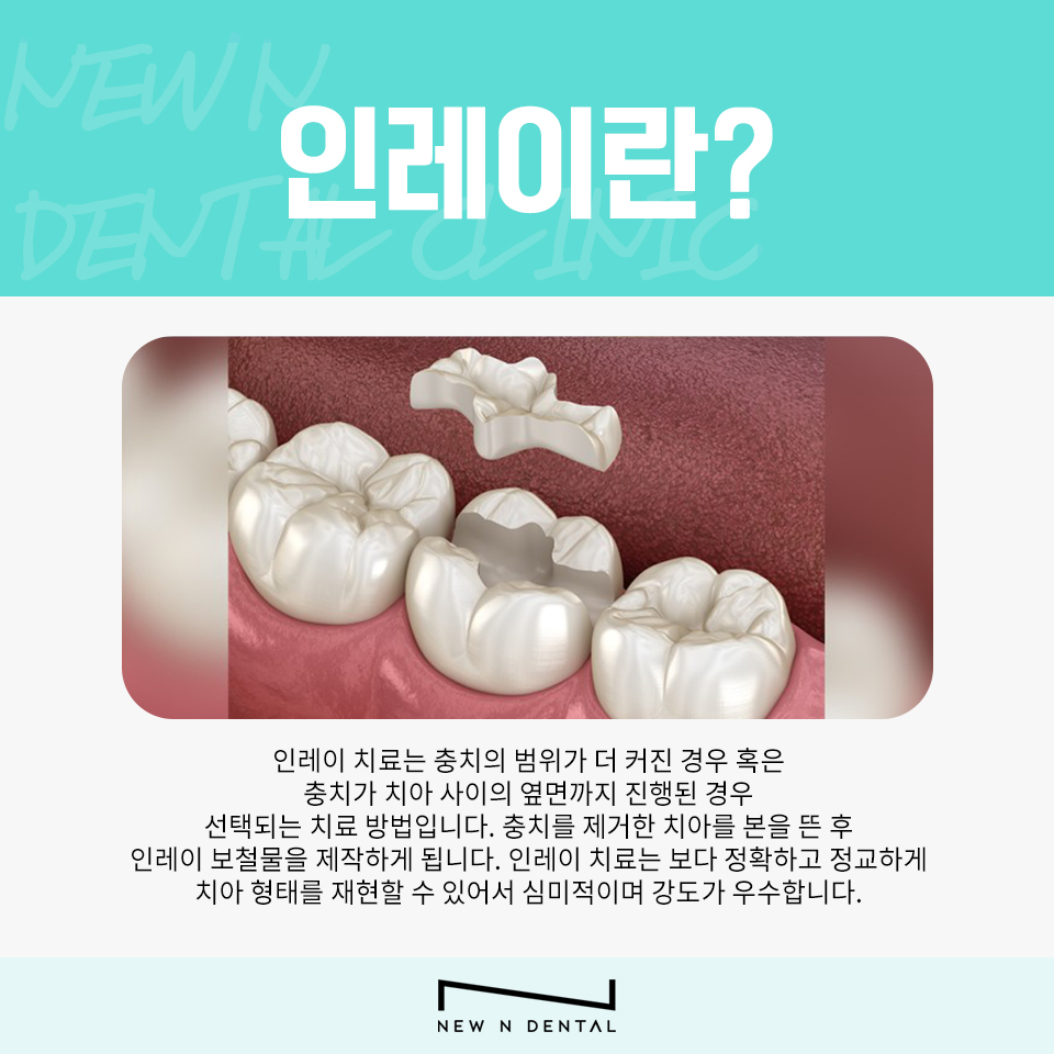 강남역충치치료 미루면 더 커지는 치아 문제 관련 이미지 8