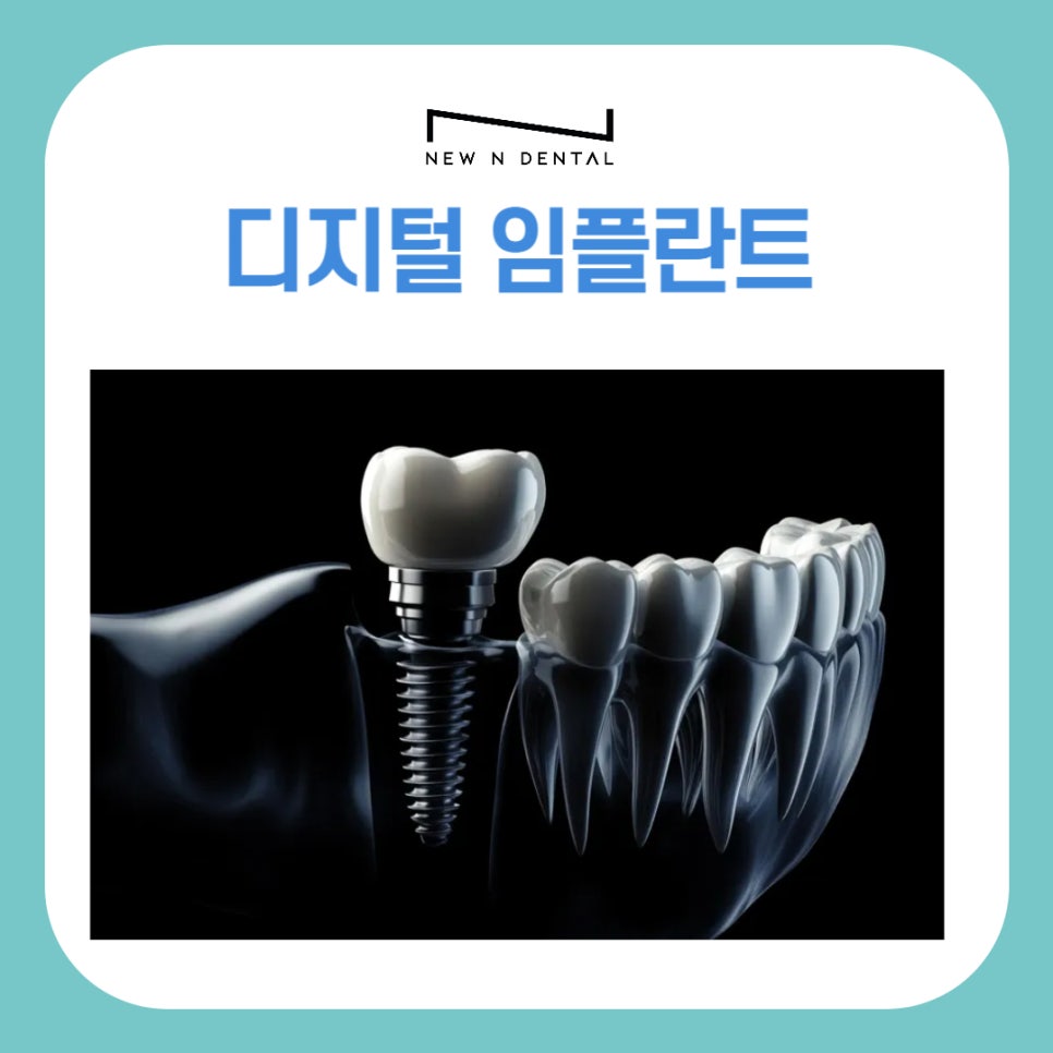강남역 디지털임플란트 맞춤화된 진료 관련 이미지 2