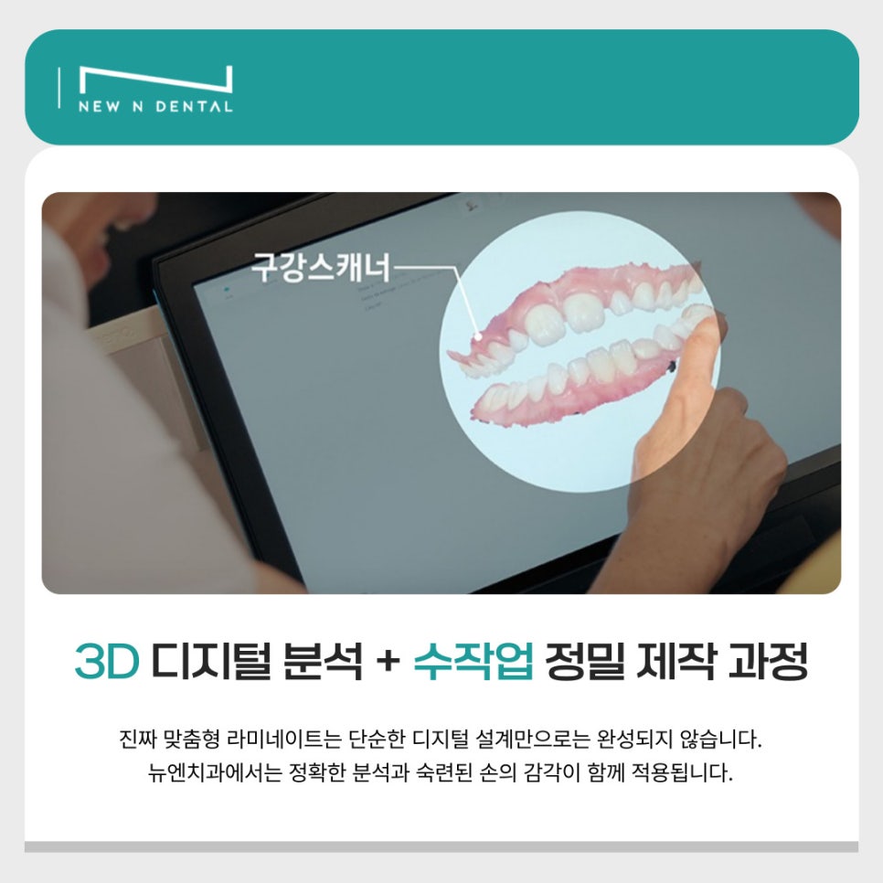 뉴엔치과만의 특별함, 퍼스널라미 관련 이미지 7