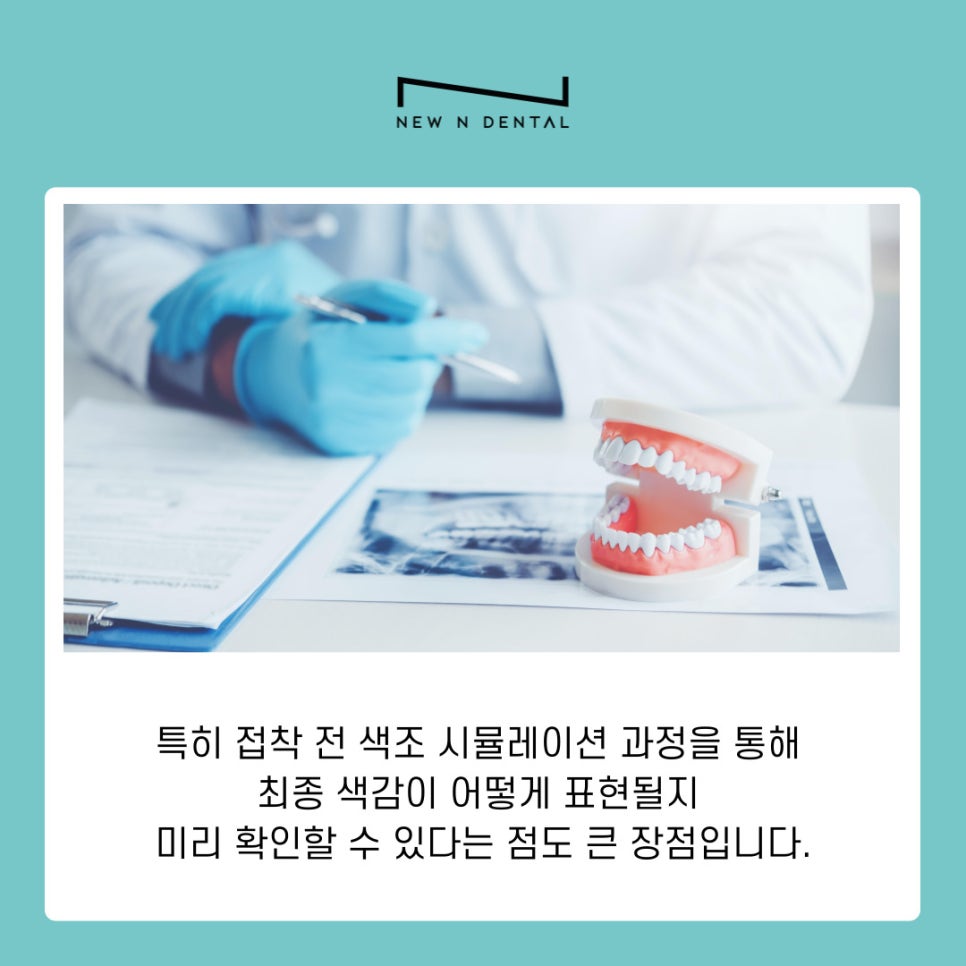 강남역치과 퍼스널라미 제로 네츄럴 차이 한눈에 관련 이미지 5