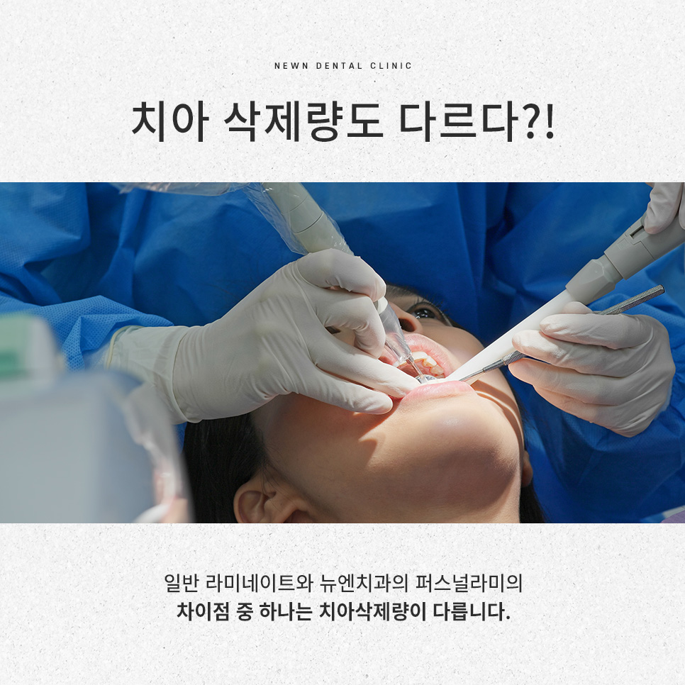 강남역 뉴엔치과 일반 라미네이트와 퍼스널라미의 차이점 관련 이미지 10