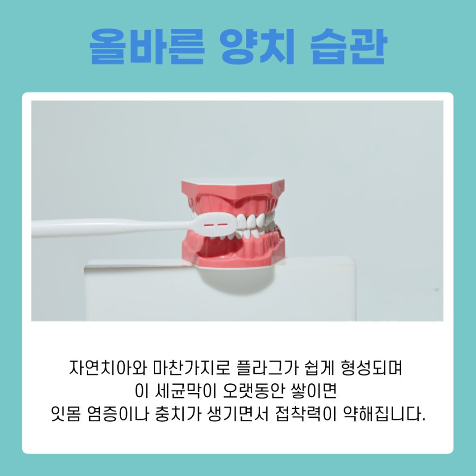 라미네이트 오래 유지하려면 알아야 할 점 관련 이미지 4