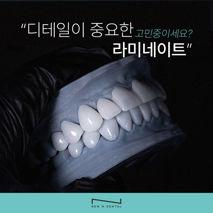 논현동라미네이트 인상이 좋아 보이도록 관련 이미지 3