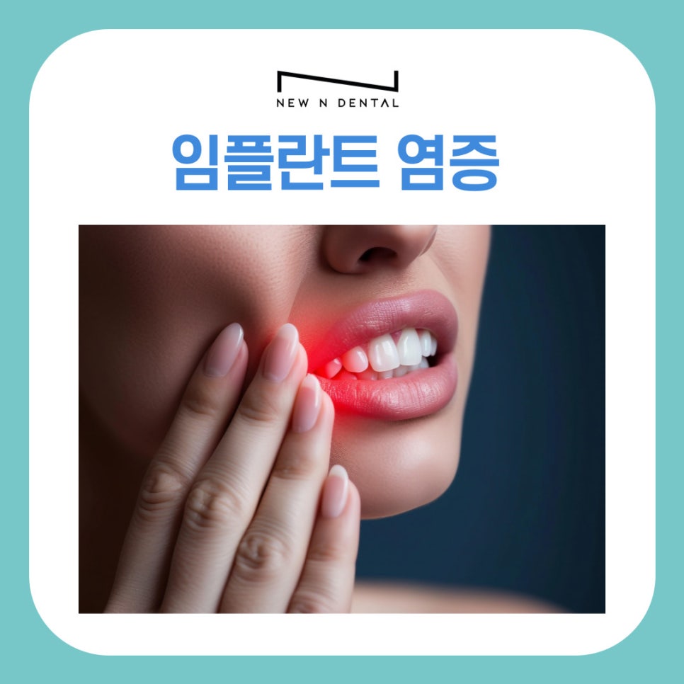 역삼동 임플란트 염증 초기 원인부터 예방법까지 한 번에 보기 관련 이미지 2