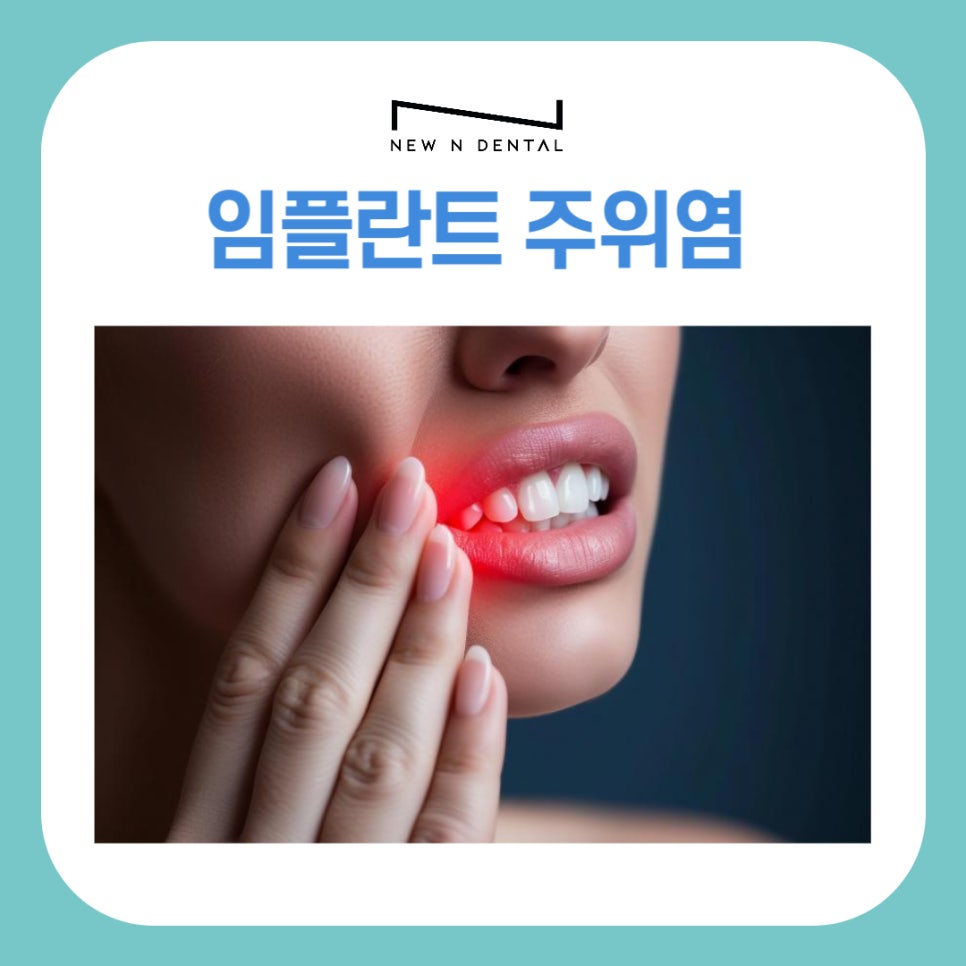 논현역치과 임플란트주위염 알아보기 관련 이미지 1