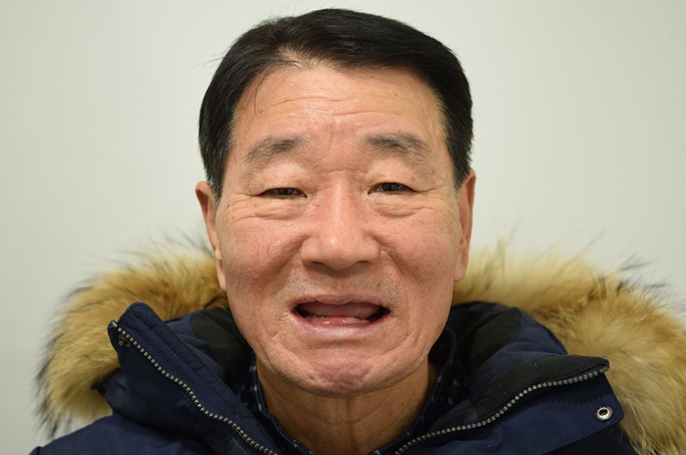 역삼동임플란트추천 치아를 건강하게 관련 이미지 8