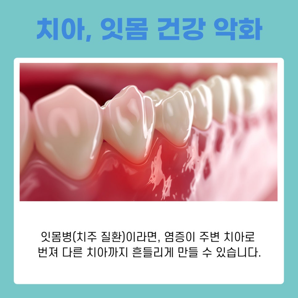 Gangnam Station Dental Clinic: Loose Permanent Teeth, How to Tell Baby Teeth from Permanent Teeth image 7