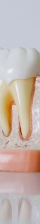 강남 전체임플란트 틀니 생각하고 있다면 관련 이미지 15