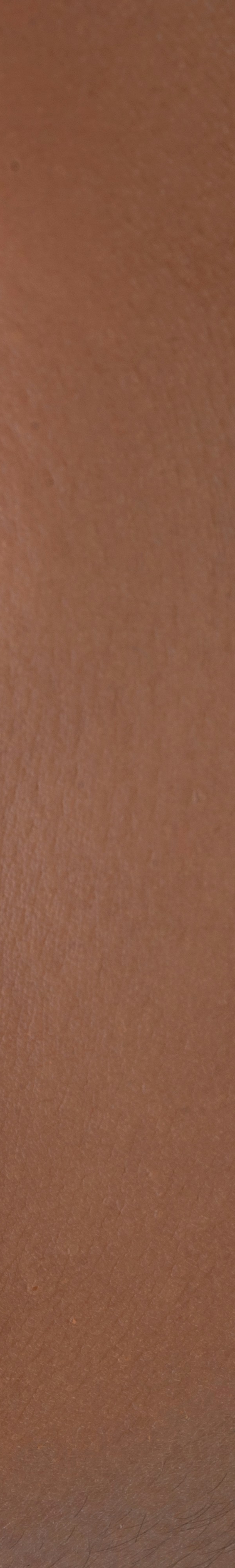 치아교정 후 유지 장치의 필요성 관련 이미지 27