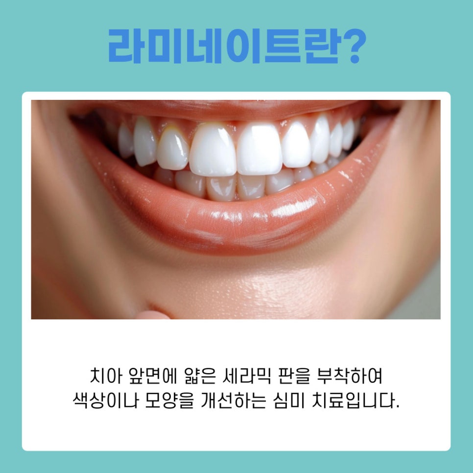 강남 무삭제 라미네이트 치아 손상 없이 예뻐지는 방법 관련 이미지 3