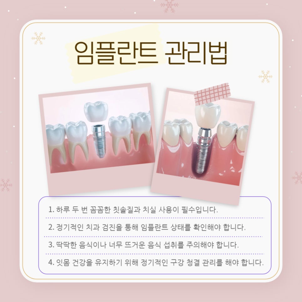 임플란트와 틀니 차이점, 나에게 맞는 선택은? 관련 이미지 11