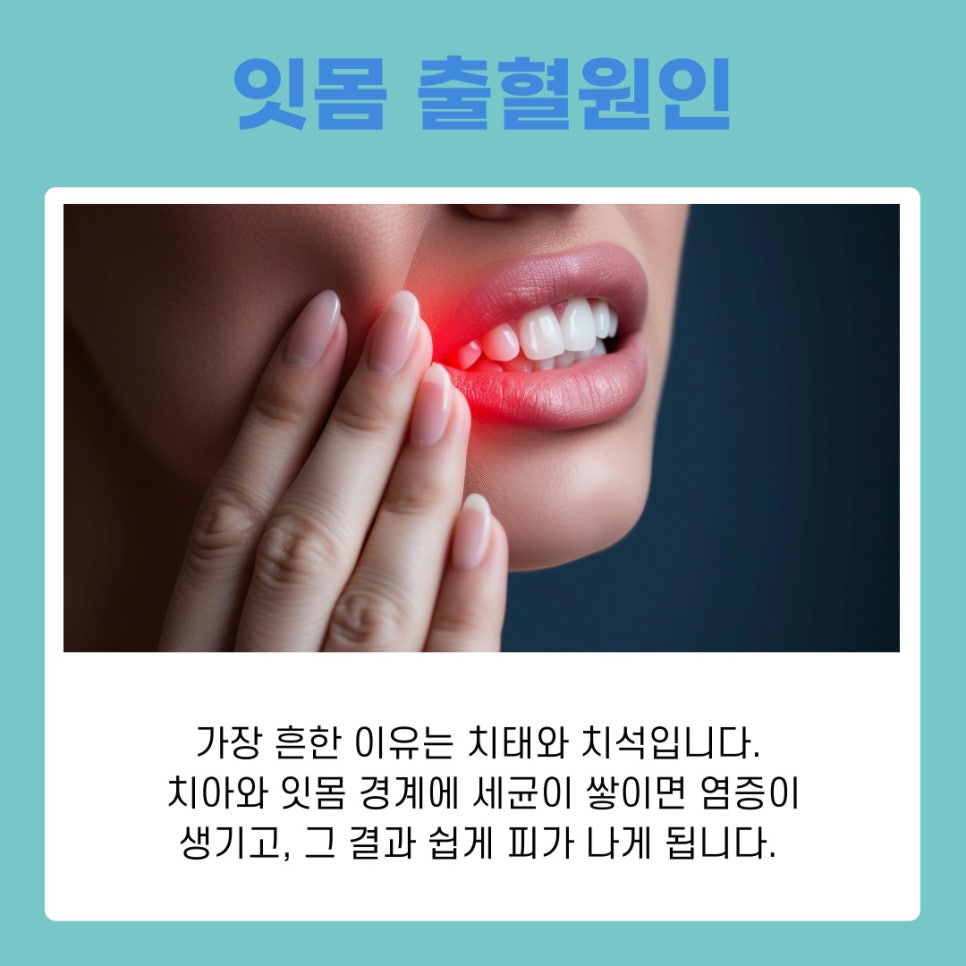서초동치과 잇몸 출혈 방치하면 안되는 이유 관련 이미지 3