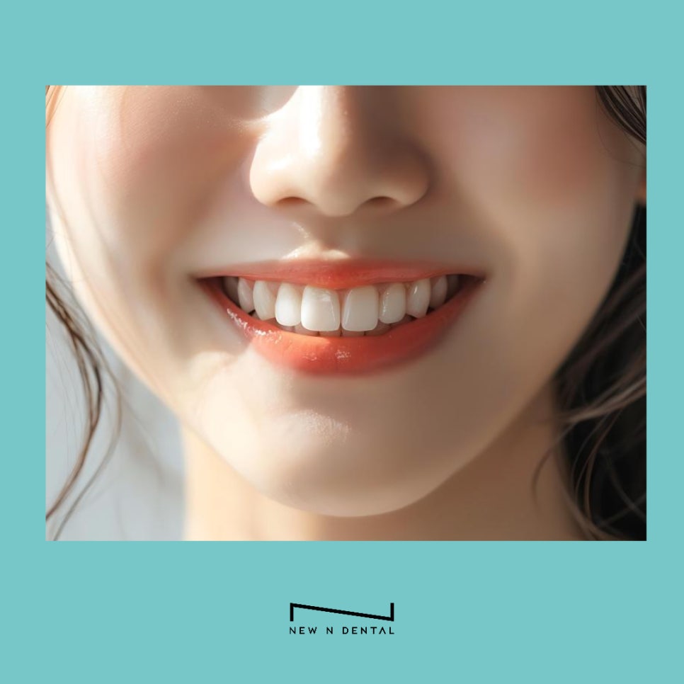 치아 지르코니아 크라운 중요한 요소 관련 이미지 7