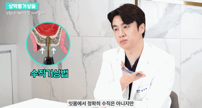 논현역치과 상악동거상술 어떤 치료일까 관련 이미지 11