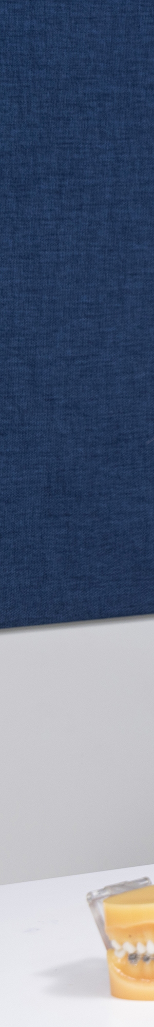 앞니 벌어짐 치료의 원인과 치료 방법 관련 이미지 15