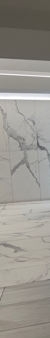 신논현치과 치아 삭제 없이 깔끔한 미소 관련 이미지 18