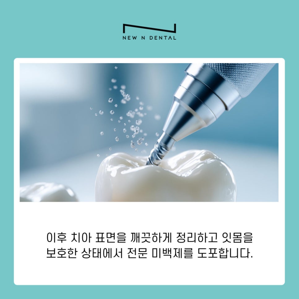 강남역 치아미백 밝은 미소를 위한 올바른 관리 방법 관련 이미지 9