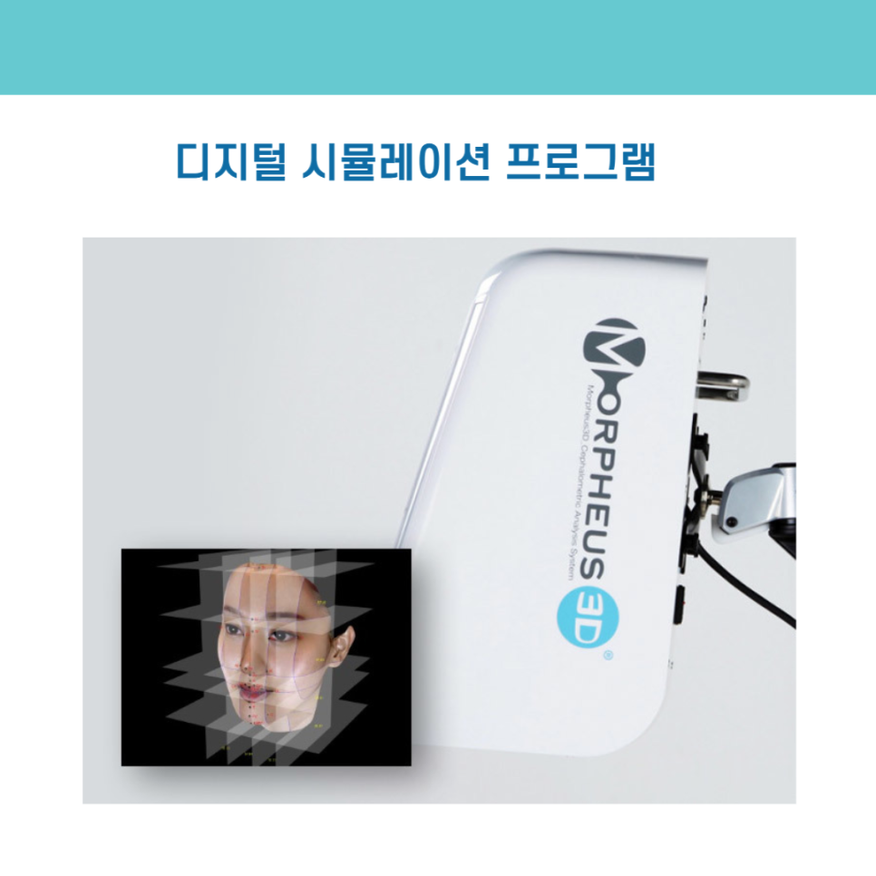 디지털 장비를 이용한 맞춤 치아 교정 관련 이미지 7