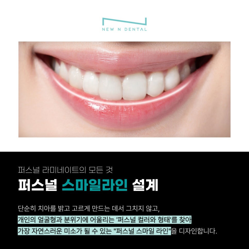 앞니심미치료로 되찾는 자연스러운 스마일 라인 관련 이미지 5