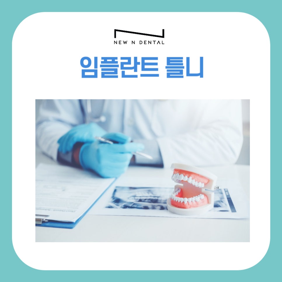 Implant Dentures for a Healthy Fit Without Wobbling image 1