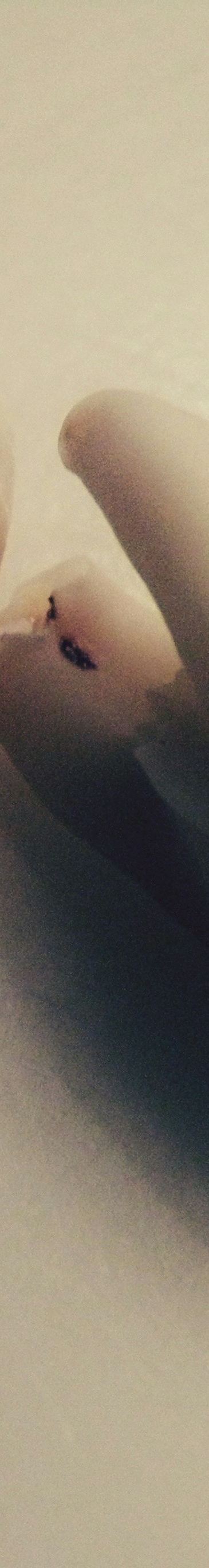 사랑니 발치 전 후 관리법 꿀팁 관련 이미지 23