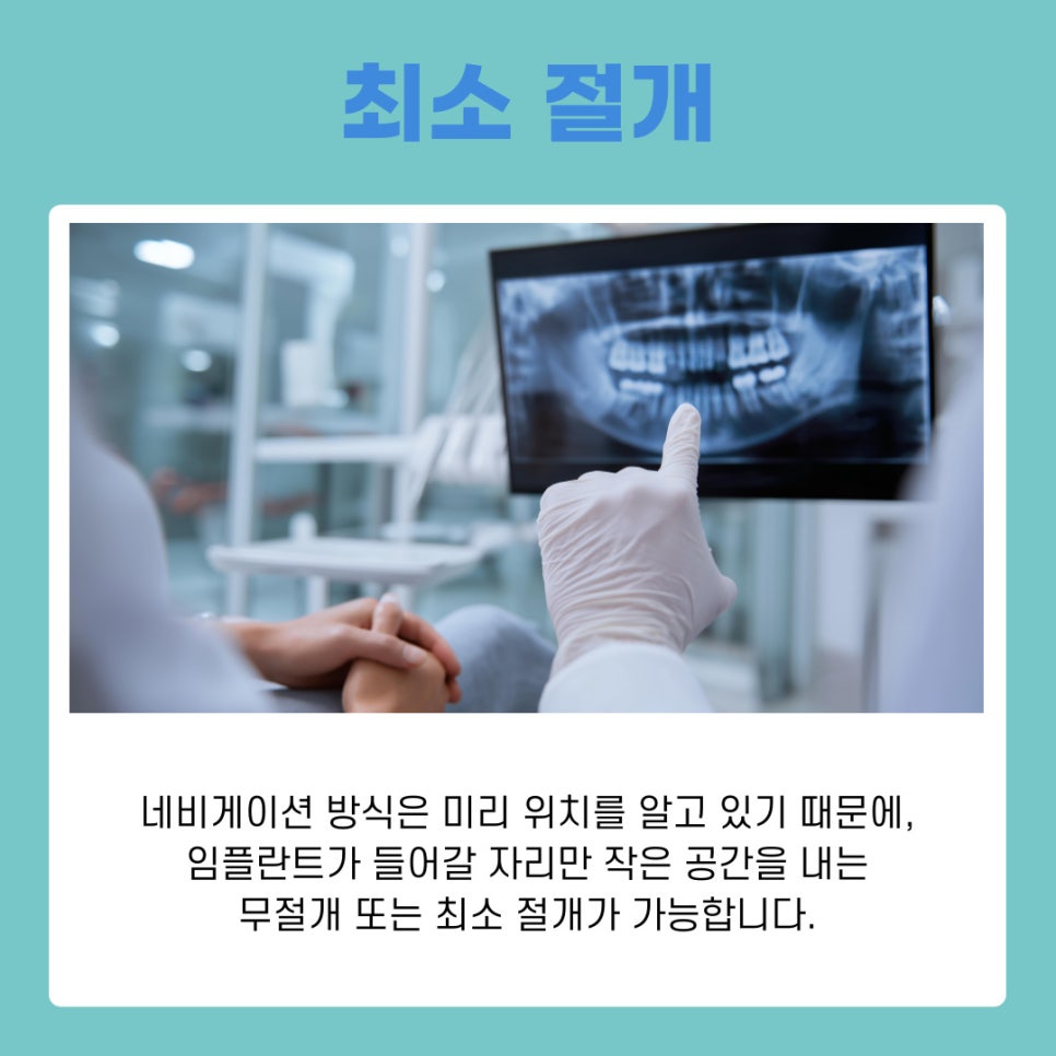 서초 임플란트치과 통증은 줄이고 정확도는 높이는 네비게이션 치료법 관련 이미지 8