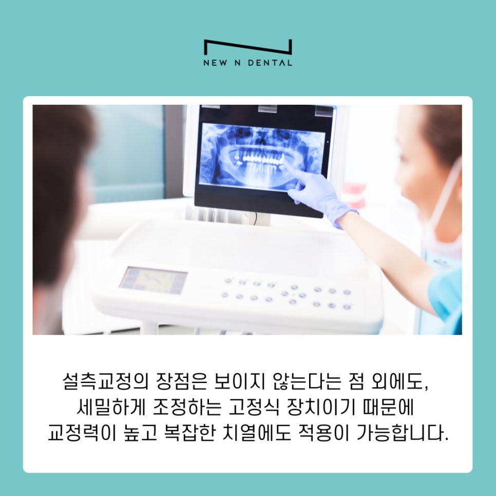 Orthodontics Near Gangnam Station: Differences Between Anterior Lingual Braces and Clear Aligners by Type image 5