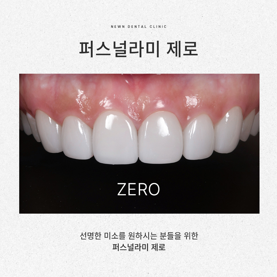 [뉴엔치과] 강남역 나에게 맞는 스마일 디자인,퍼스널라미 제로와 네츄럴 관련 이미지 3