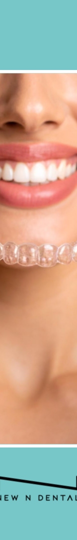 앞니투명교정, 강남치아교정치과에서 궁금증 해결하기 관련 이미지 13