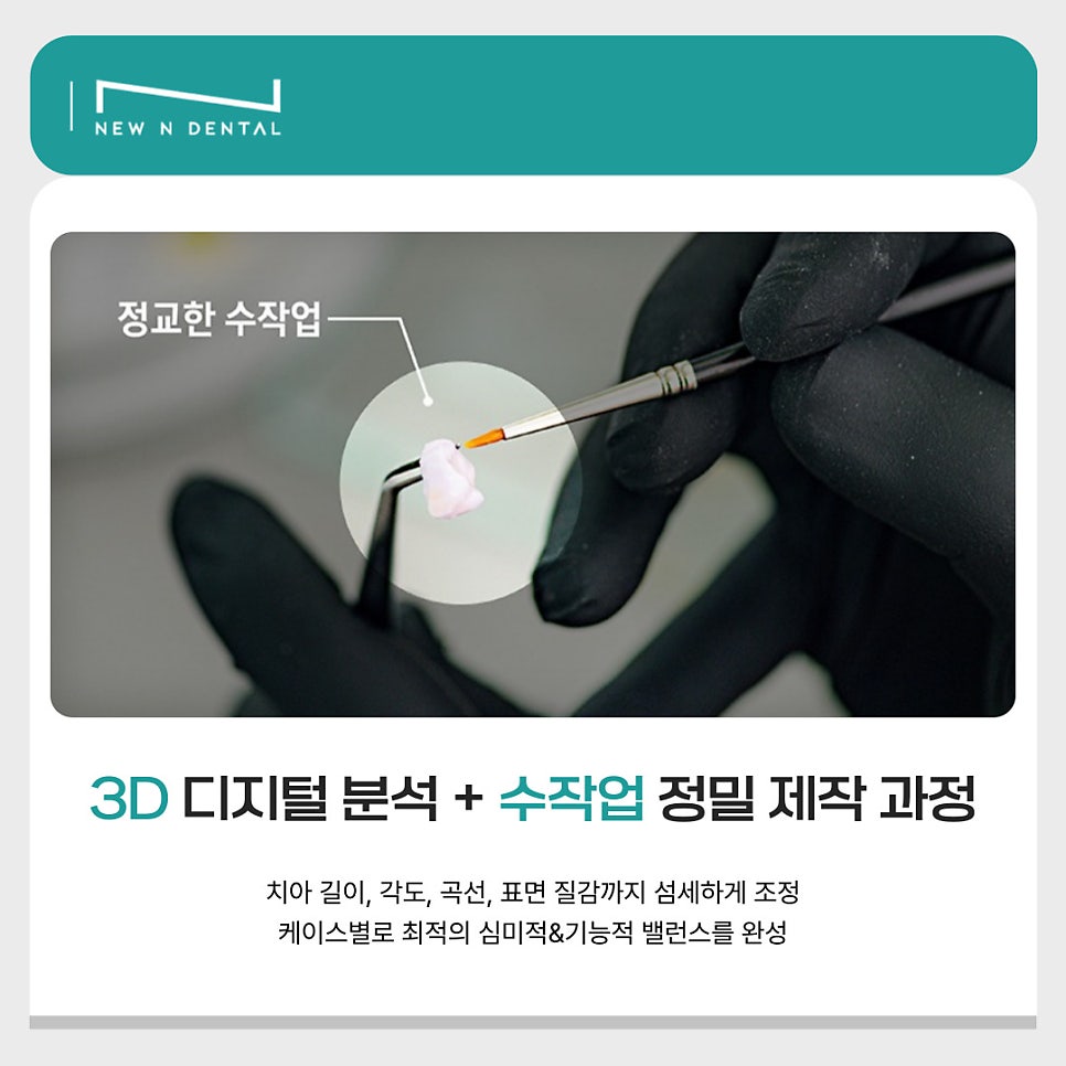 뉴엔치과만의 특별함, 퍼스널라미 관련 이미지 8
