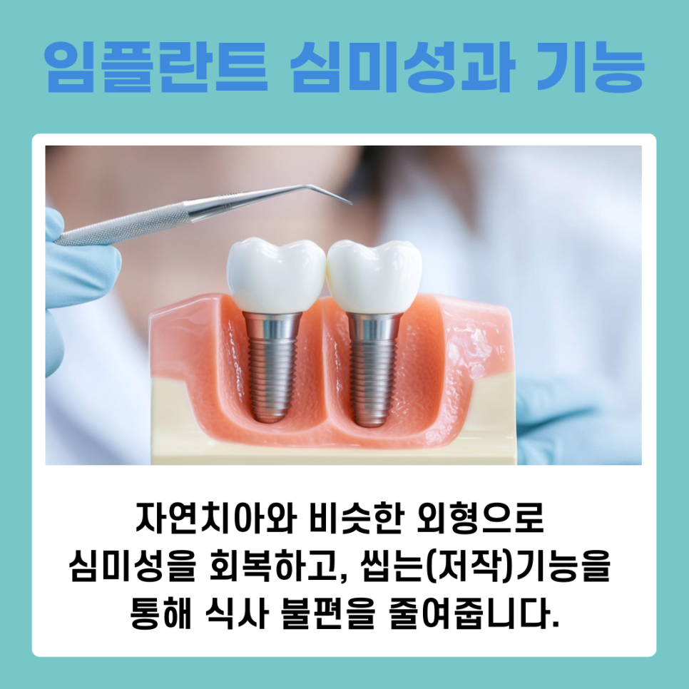 앞니 임플란트 식립 주의해야 할 사항은? 관련 이미지 6