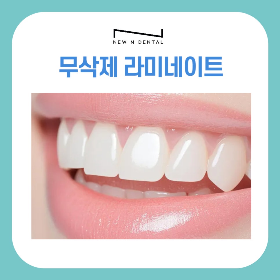 강남 무삭제라미네이트 치아깎지않는 개선방법 관련 이미지 2