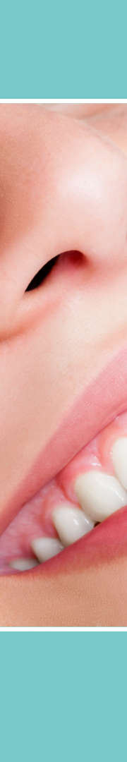 치아변색원인과 스케일링치료로 개선하는 방법 관련 이미지 11