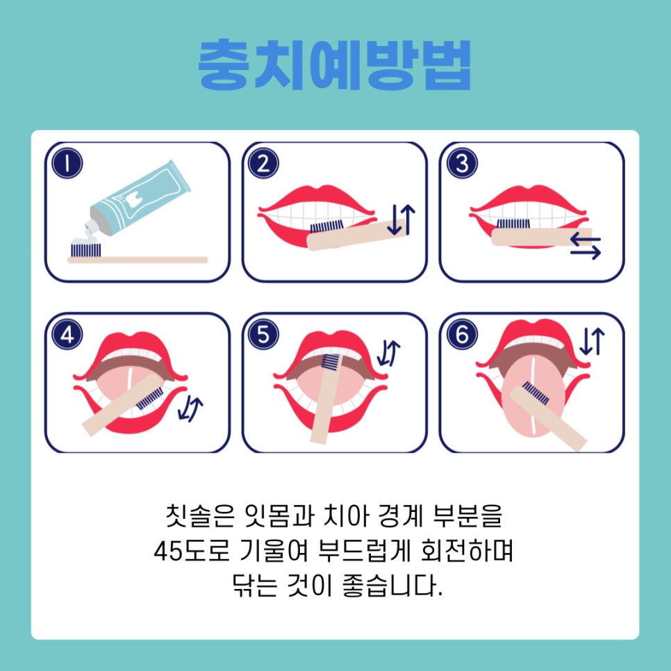 Seocho-dong Dental Clinic: Dental Regular Checkups and How to Prevent Cavities Properly image 6