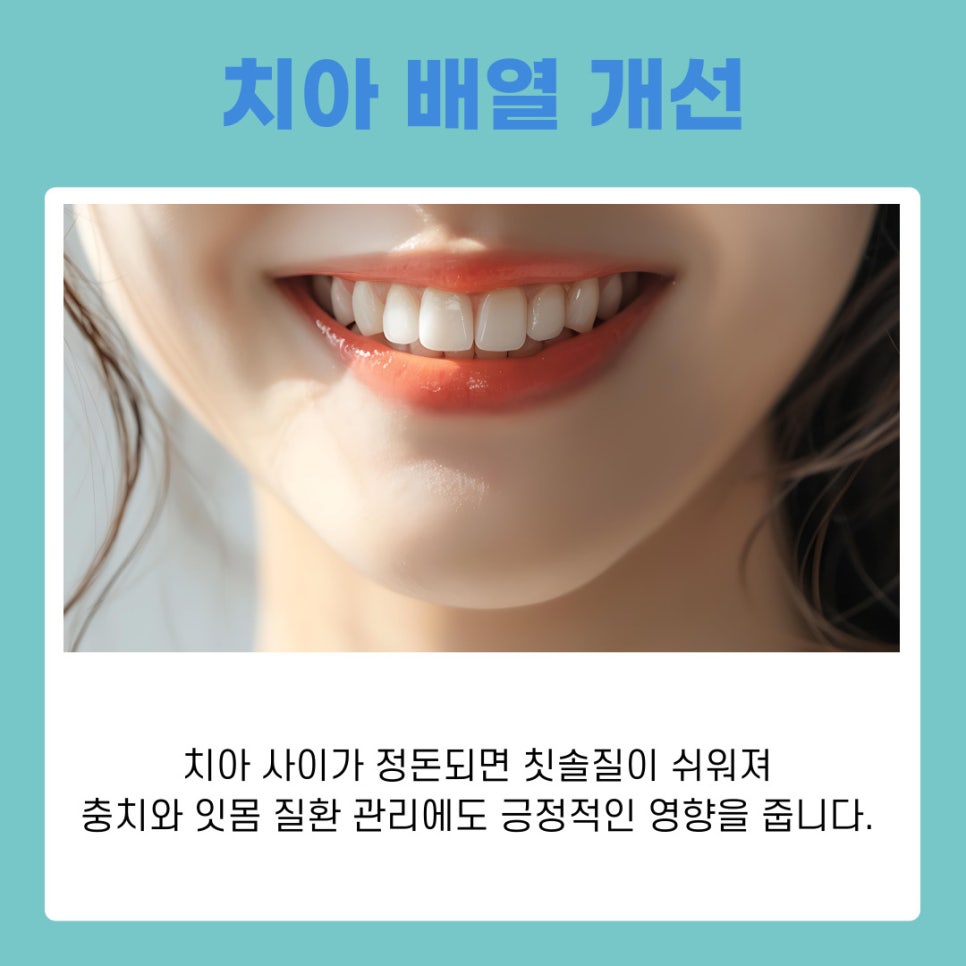 서초구교정치과 치료 전 반드시 알아야 할 기본 정보 정리 관련 이미지 8