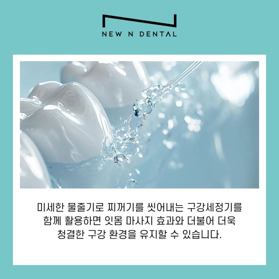 Proper Aftercare and Regular Checkups to Extend the Lifespan of Implants in Gangnam-gu image 9