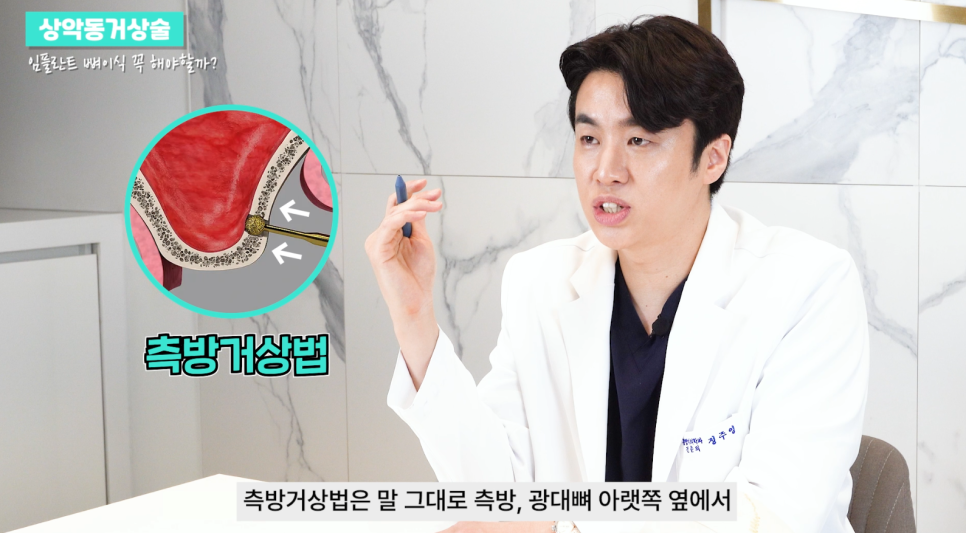 상악동거상술 임플란트 성공률 높이기 관련 이미지 10