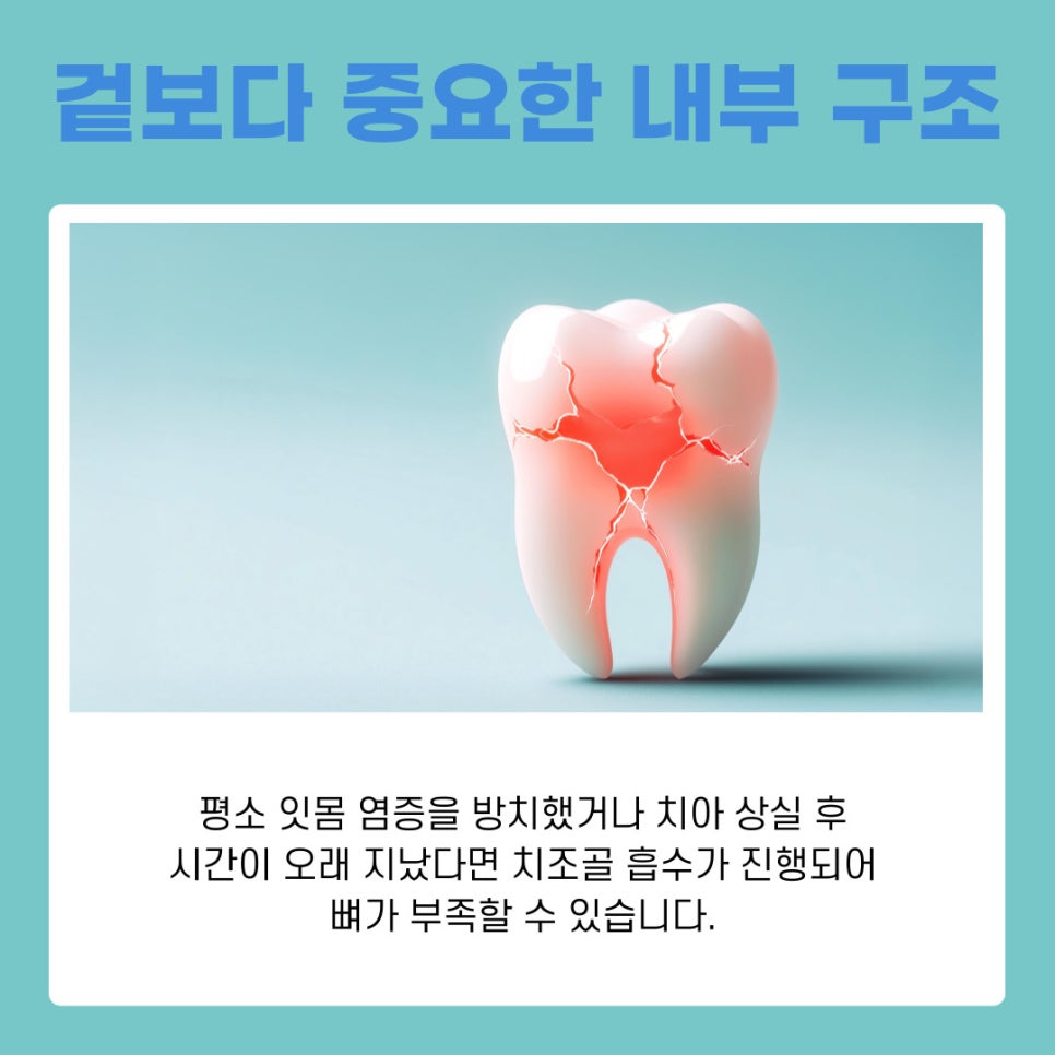 서초동치과 임플란트 오래 쓰는 비결 사후관리 핵심 포인트 관련 이미지 3
